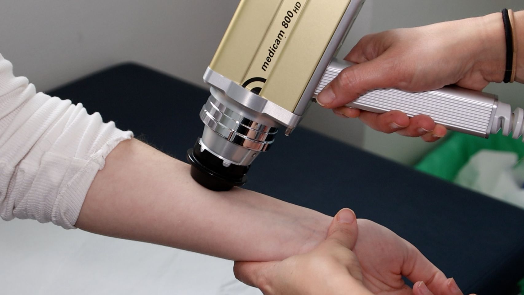 Examen de lesiones en la piel con un dermatoscopio en un hospital Ribera