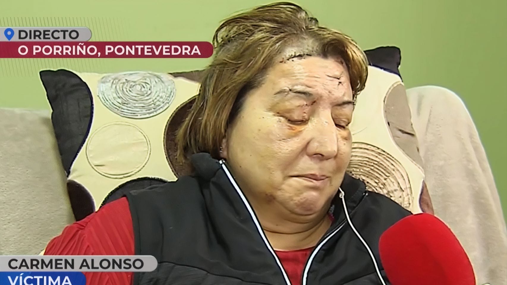 Carmen Alonso, víctima de la agresión en O Porriño (Pontevedra).